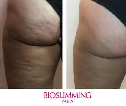 BIOSLIMMING Eelde